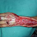 Click image for larger version

Name:	ASI_Snakebite_Mozzie_Bite_Symptoms_2_web-350x350.jpg
Views:	747
Size:	24.1 KB
ID:	132890